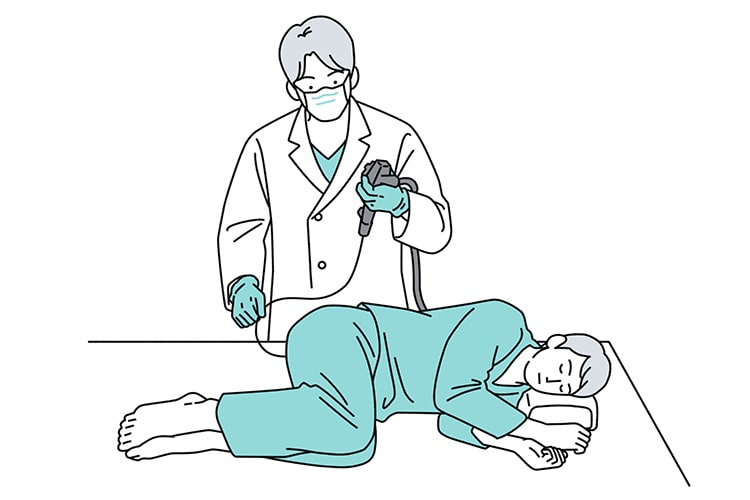 大腸カメラ検査についてのイメージイラスト